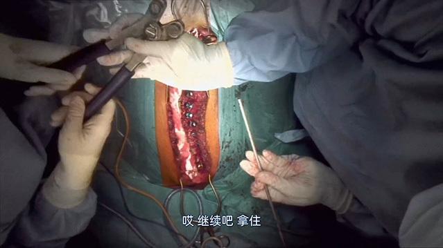 人体结构剧照